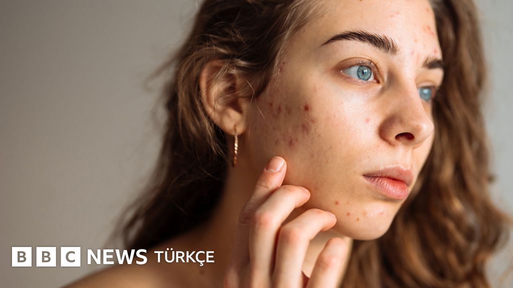 Gençler için gerçekten işe yarayan basit cilt bakımı rutini