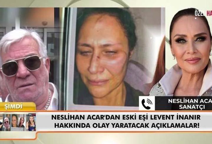 Neslihan Acar'dan 'Neler Oluyor Hayatta' Programına Çarpıcı Açıklamalar: Levent İnanır'dan Şiddet Gördüm! 14 Yıl Sonra Gelen O Fotoğraf!