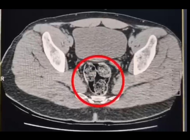 Kars'ta otobüste 307,94 gram metamfetamin bulundu, 2 İranlı şüpheli tutuklandı