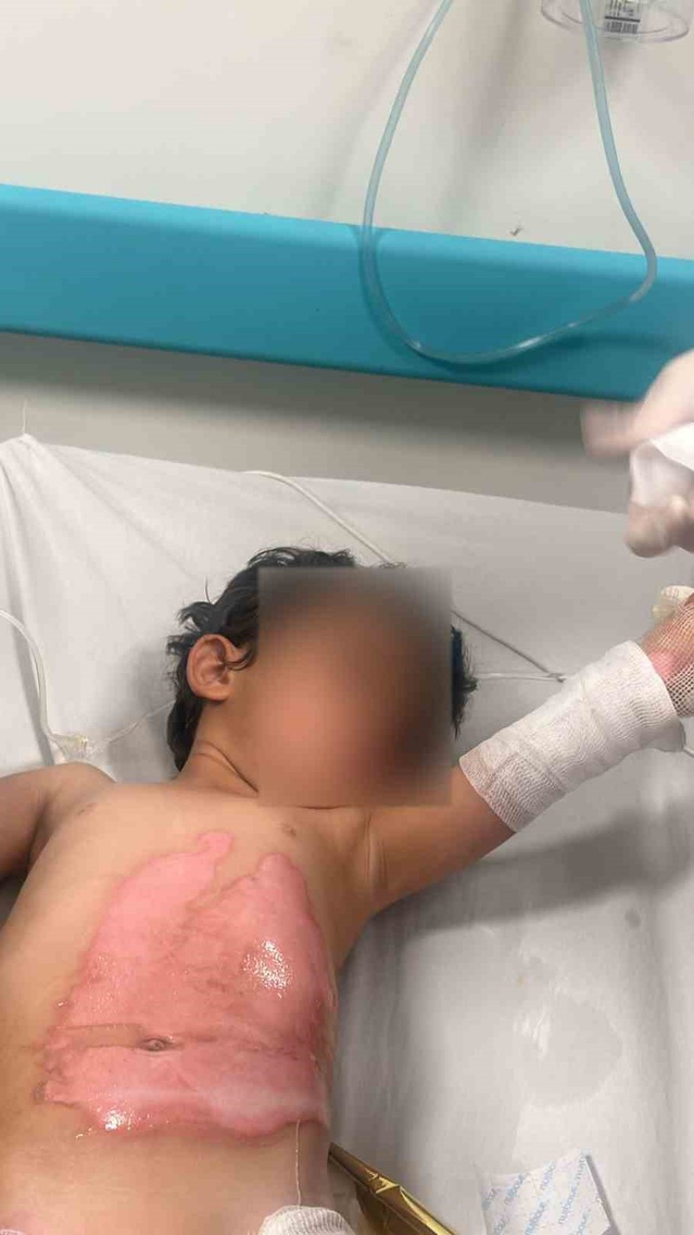 İddiaya göre Şırnak Kumçatı'da kaynar kazan devrildi, 3 yaşındaki çocuk yaralandı
