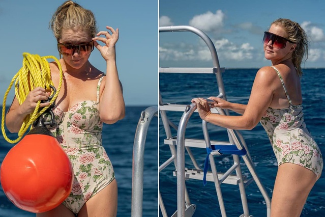 Amy Schumer kilo verdikten sonra eşinden ayrıldı: Cushing sendromu teşhisini açıkladı