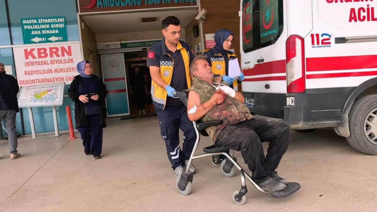 Odun keserken elini motorlu testereye kaptırdı!