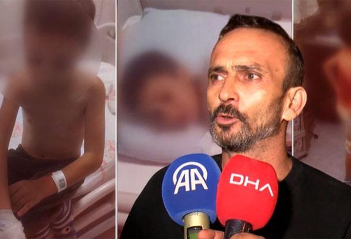 İstanbul'da akran dehşeti! Sırtına kolonya döküp yaktılar