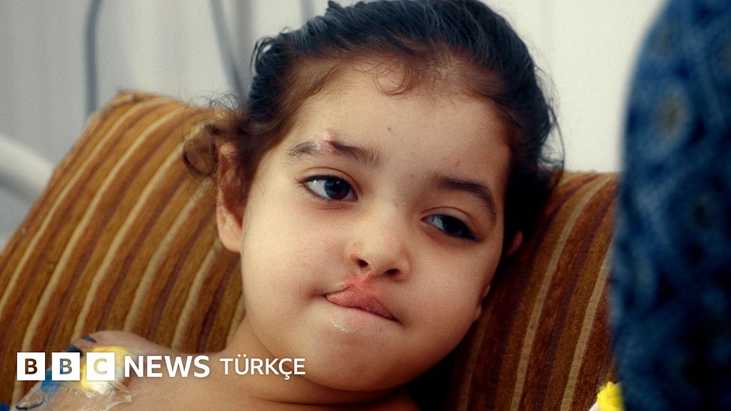 Gazze'de geçen yaz: Fare istilasındaki kamplar ve iyileşmeyen yaralar