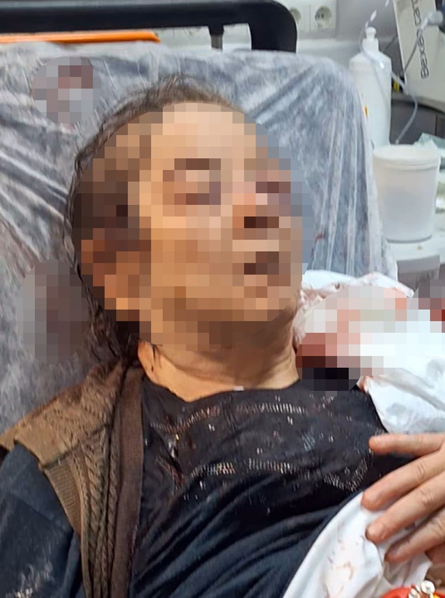 Kayseri'de tavandan kopan moloz altında kalan 75 yaşındaki F.Ö. görme kaybı yaşadı