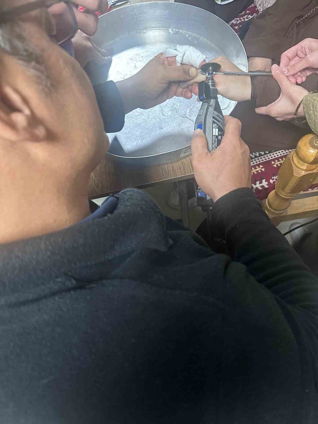 Batman'da parmağına yüzük sıkışan vatandaşa hastanede itfaiye ekipleri müdahale etti