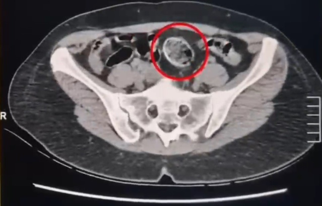 Kars'ta vücutlarında 307,94 gram metamfetamin taşıyan 2 İranlı şüpheli tutuklandı