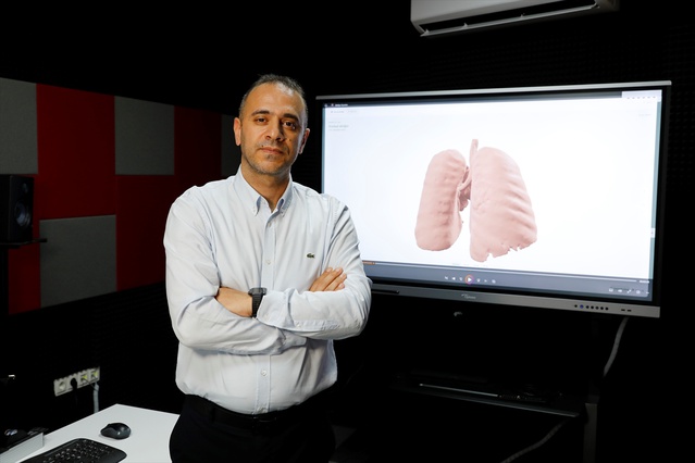 Samsun Üniversitesi akciğer kanserine yapay zeka destekli sistem geliştiriyor