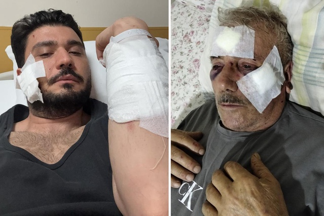 İzmit'te muşta kullandığı iddia edilen tarafın avukatı muşta kullanmadığını söyledi
